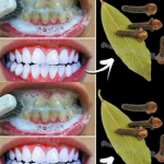Domowe wybielanie zębów i usuwanie kamienia nazębnego